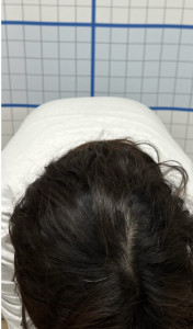 腰痛アフター