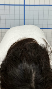 腰痛ビフォー