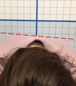 首肩痛アフター